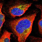 SEC23B Polyclonal Antibody