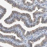SEC23B Antibody in Immunohistochemistry (Paraffin) (IHC (P))