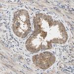 SEC23B Antibody in Immunohistochemistry (Paraffin) (IHC (P))
