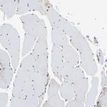 SEC23B Antibody in Immunohistochemistry (Paraffin) (IHC (P))