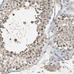 SEC23B Antibody in Immunohistochemistry (Paraffin) (IHC (P))