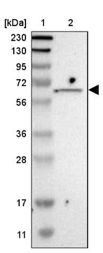 ISYNA1 Antibody in Western Blot (WB)