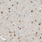 MCPH1 Antibody in Immunohistochemistry (Paraffin) (IHC (P))