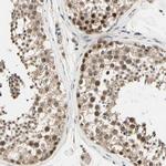 MCPH1 Polyclonal Antibody