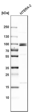 MCPH1 Antibody in Western Blot (WB)