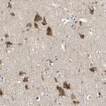 CGREF1 Polyclonal Antibody