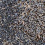 ME2 Antibody in Immunohistochemistry (IHC)