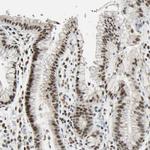 C1orf174 Antibody in Immunohistochemistry (Paraffin) (IHC (P))