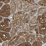 LPGAT1 Antibody in Immunohistochemistry (IHC)