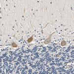 LPGAT1 Antibody in Immunohistochemistry (IHC)