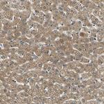 LPGAT1 Antibody in Immunohistochemistry (IHC)