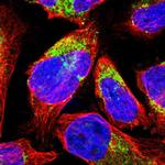 MCCC1 Polyclonal Antibody