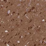 MCCC1 Antibody in Immunohistochemistry (Paraffin) (IHC (P))