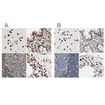 FAM98B Antibody in Immunohistochemistry (IHC)