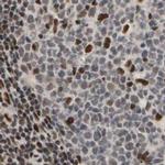 FAM98B Antibody in Immunohistochemistry (IHC)