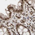 FAM98B Antibody in Immunohistochemistry (IHC)