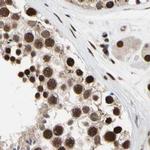 FAM98B Antibody in Immunohistochemistry (IHC)