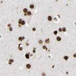 FAM98B Antibody in Immunohistochemistry (IHC)