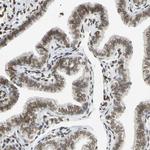 UNC84A Antibody in Immunohistochemistry (Paraffin) (IHC (P))