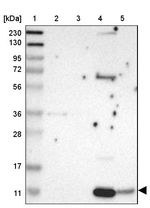 PPBP Antibody in Western Blot (WB)
