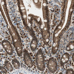 LTA4H Antibody in Immunohistochemistry (Paraffin) (IHC (P))
