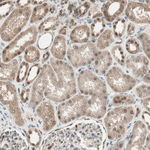 LTA4H Antibody in Immunohistochemistry (Paraffin) (IHC (P))