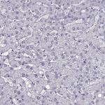 QPCT Antibody in Immunohistochemistry (Paraffin) (IHC (P))