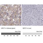 QPCT Antibody in Immunohistochemistry (IHC)