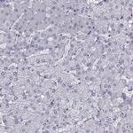 QPCT Antibody in Immunohistochemistry (IHC)