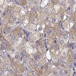 QPCT Antibody in Immunohistochemistry (IHC)
