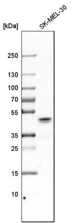 QPCT Antibody in Western Blot (WB)