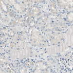 CKAP2 Antibody in Immunohistochemistry (Paraffin) (IHC (P))