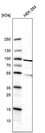 CKAP2 Antibody in Western Blot (WB)