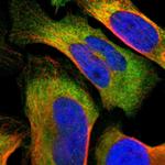 TCP-1 eta Polyclonal Antibody