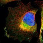 ITGA7 Polyclonal Antibody