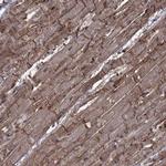 ITGA7 Antibody in Immunohistochemistry (Paraffin) (IHC (P))
