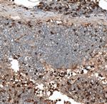 HJURP Antibody in Immunohistochemistry (IHC)