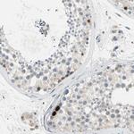 HJURP Antibody in Immunohistochemistry (IHC)