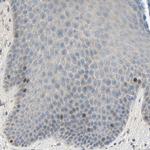 HJURP Antibody in Immunohistochemistry (IHC)