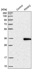PANK2 Antibody in Western Blot (WB)