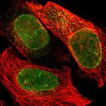 UNC84A Polyclonal Antibody