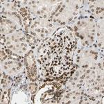 UNC84A Antibody in Immunohistochemistry (Paraffin) (IHC (P))