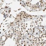 UNC84A Antibody in Immunohistochemistry (Paraffin) (IHC (P))