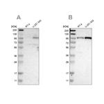 UNC84A Antibody in Western Blot (WB)