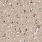 TDRP Antibody in Immunohistochemistry (Paraffin) (IHC (P))