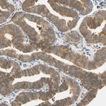 TDRP Antibody in Immunohistochemistry (Paraffin) (IHC (P))