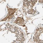 TDRP Antibody in Immunohistochemistry (Paraffin) (IHC (P))