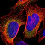 KLHDC8B Polyclonal Antibody