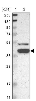 KLHDC8B Antibody in Western Blot (WB)