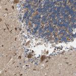 KLHDC8B Antibody in Immunohistochemistry (IHC)